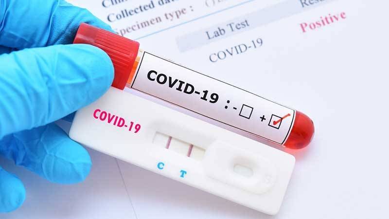 Nearly 400 students tested positive for COVID during first term in SVG