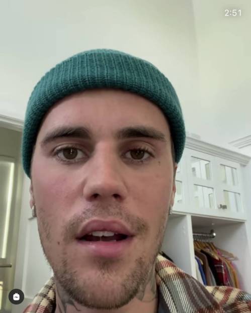 Justin Bieber Has Facial Paralysis, Reveals Ramsay Hunt Syndrome Diagnosis in Video Message