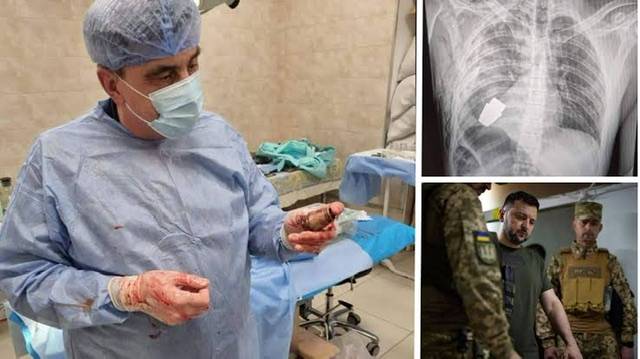 Surgeons removed an Unexploded grenade from a Ukrainian soldier's chest